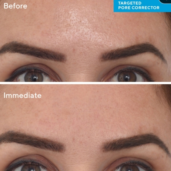 NWOB MURAD TARGETED PORE CORRECTOR - Picture 7 of 15